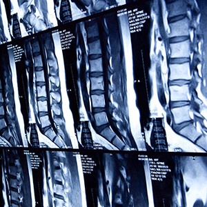 xrays